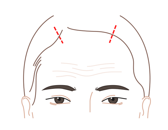 절개 부위 체크