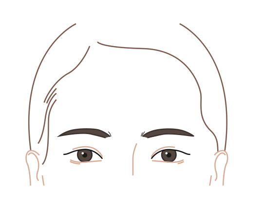수술 후 변화된 모습 이미지
