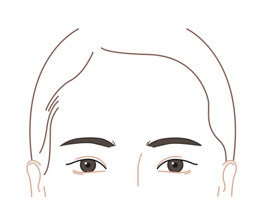 수술 후 변화된 모습 이미지