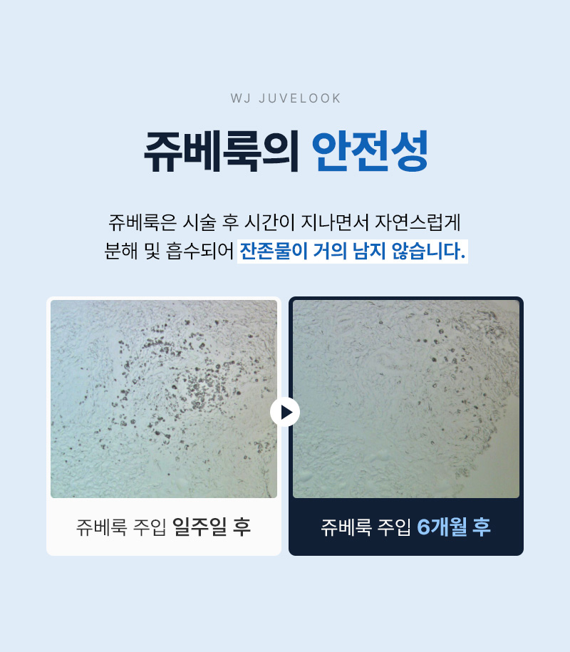 광고랜딩