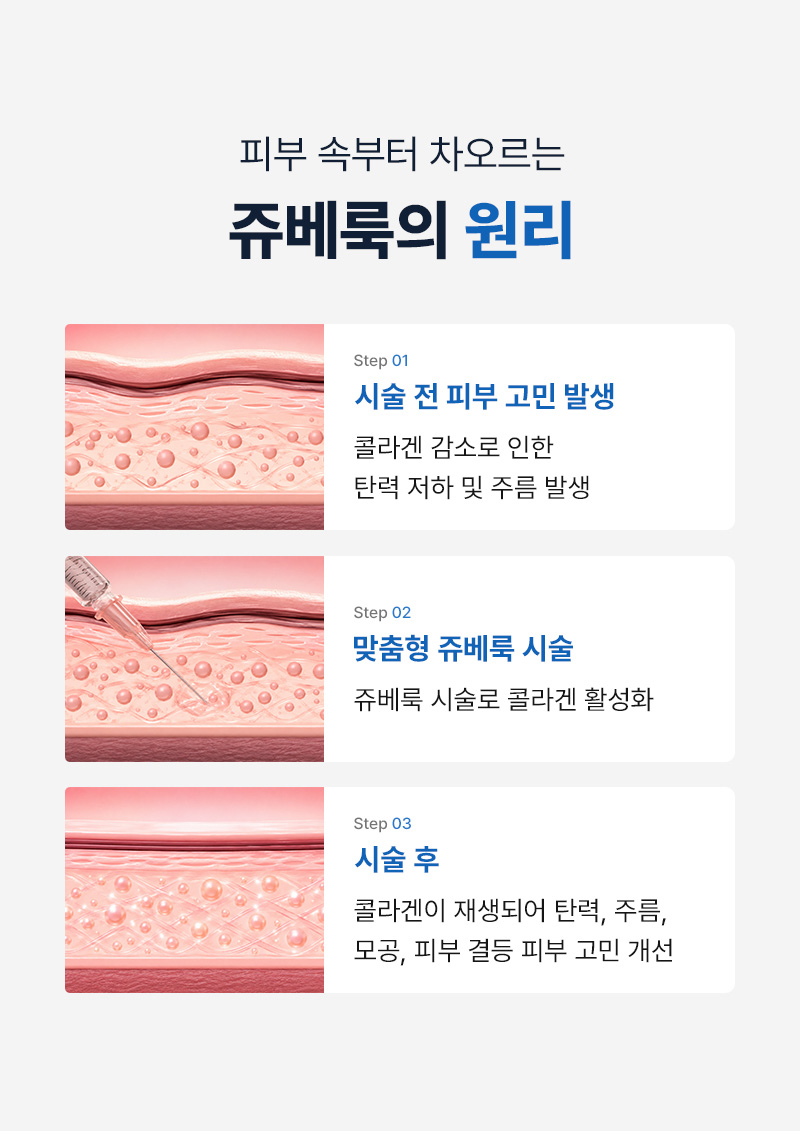 광고랜딩
