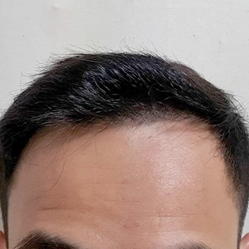 비건모자