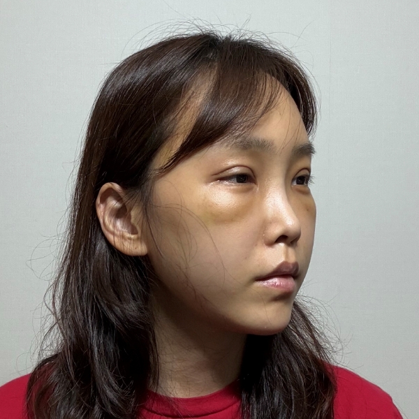 판판이의 꿈